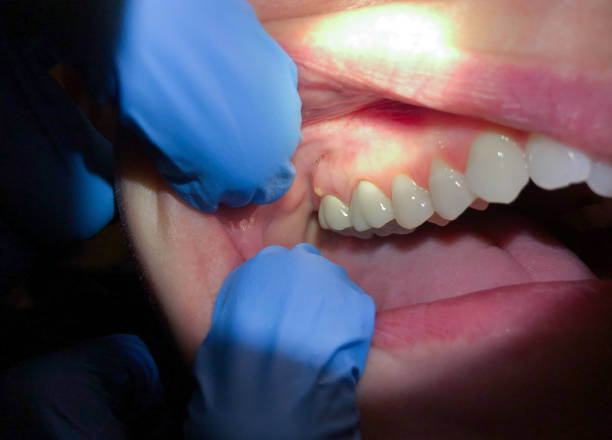 Best Emergency Dental Services for Seniors in Ocean Acres, NJ