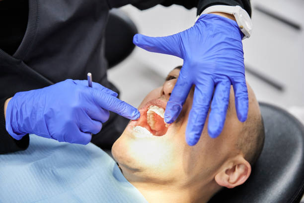Best Emergency Dentist for Knocked-Out Tooth in Ocean Acres, NJ